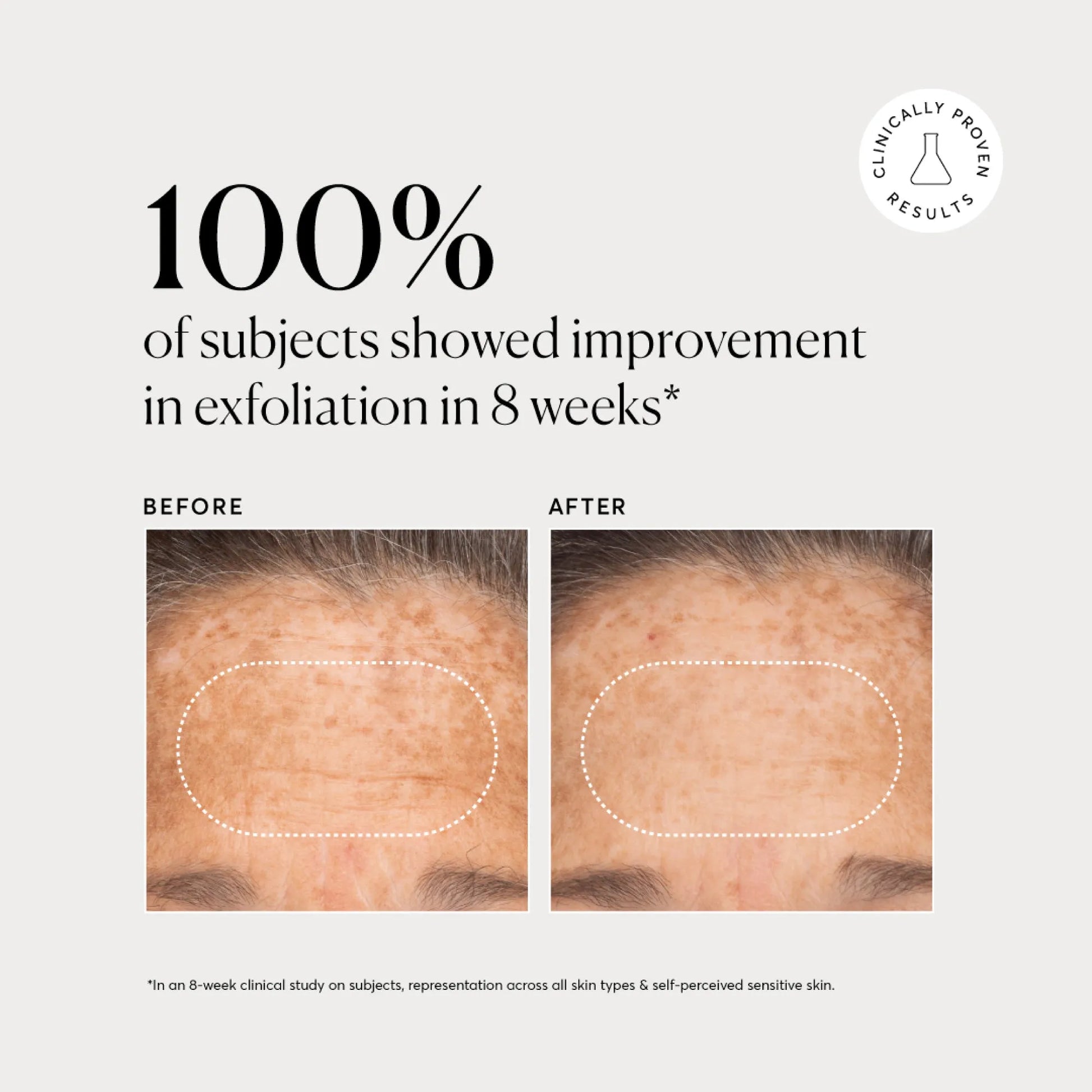 bha-liquid-exfoliant-2-i1 NATR-10027-Alt-Images-BHA-Liquid-Exfoliant-2_-03.webp