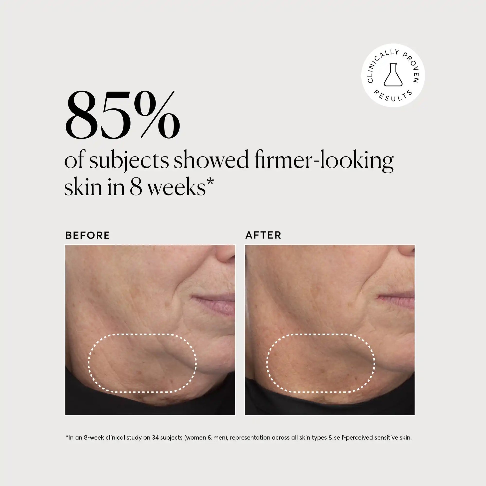 retinol-complex-serum-q6 NATR-10034-Alt-Images-Retinol-Complex-Serum-04.webp